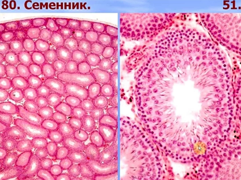 Придаток семенника рисунок гистология