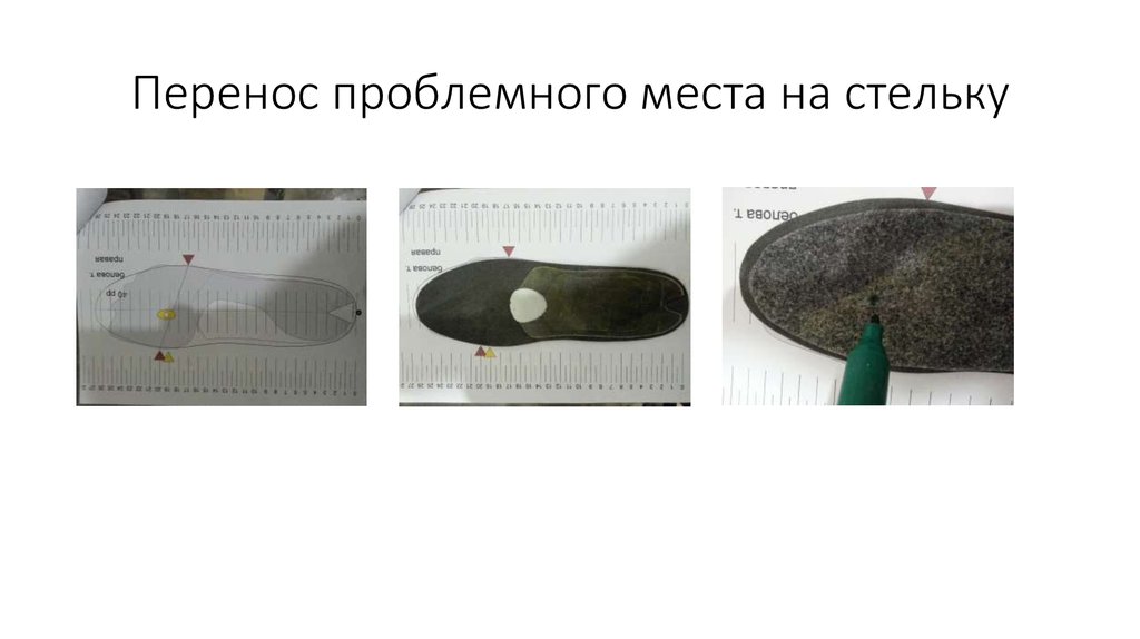 Перенос проблемного места на стельку