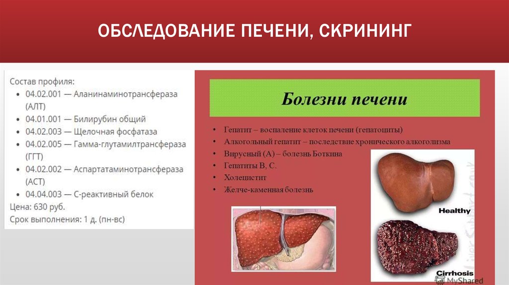 ОБСЛЕДОВАНИЕ ПЕЧЕНИ, СКРИНИНГ