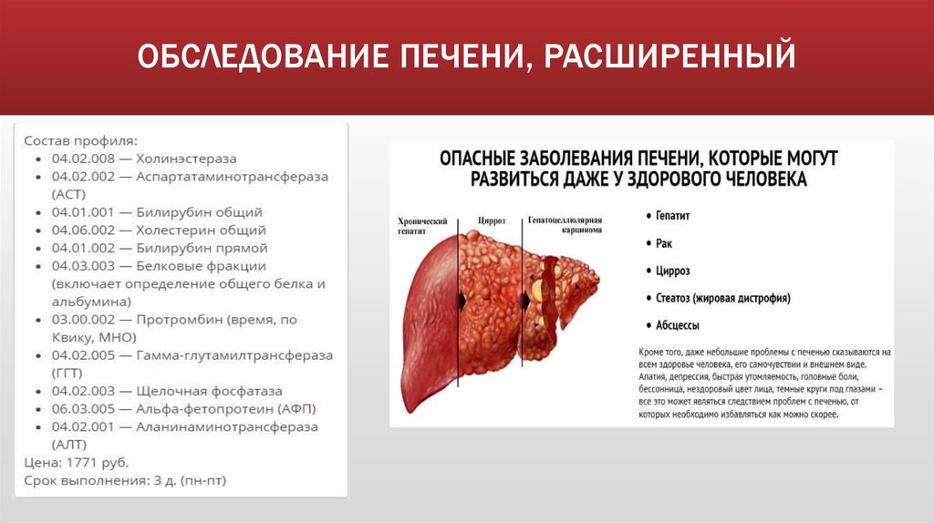 ОБСЛЕДОВАНИЕ ПЕЧЕНИ, РАСШИРЕННЫЙ