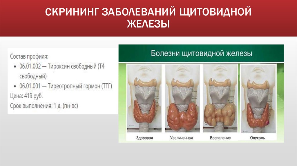 СКРИНИНГ ЗАБОЛЕВАНИЙ ЩИТОВИДНОЙ ЖЕЛЕЗЫ