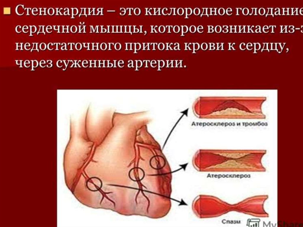 Для сердечной боли характерно