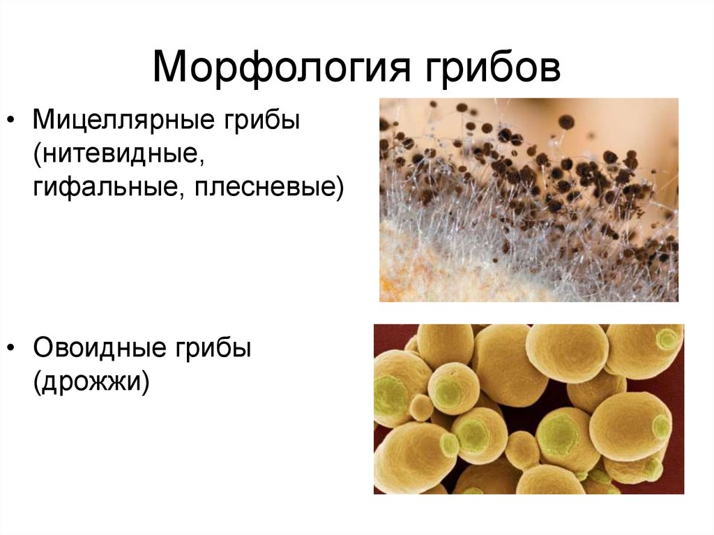 Грибы заболевания вызываемые вирусом. Плесневые грибы микробиология строение. Мицелиальные грибы микробиология морфология. Грибы, плесневые грибы, дрожжи микробиология.