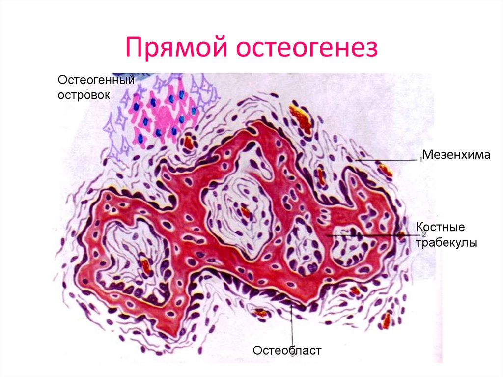 Непрямой остеогенез. Мембранозный остеогенез. Развитие кости из мезенхимы прямой остеогенез. Мезенхима костной ткани. Прямой остеогенез гистология схема.