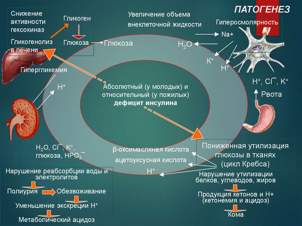 Нмо сахарный диабет этиология патогенез. Патогенез гипергликемии. Гипергликемия этиология патогенез. Патогенез гипергликемии при сахарном диабете. Патогенез дегидратации при сахарном диабете.