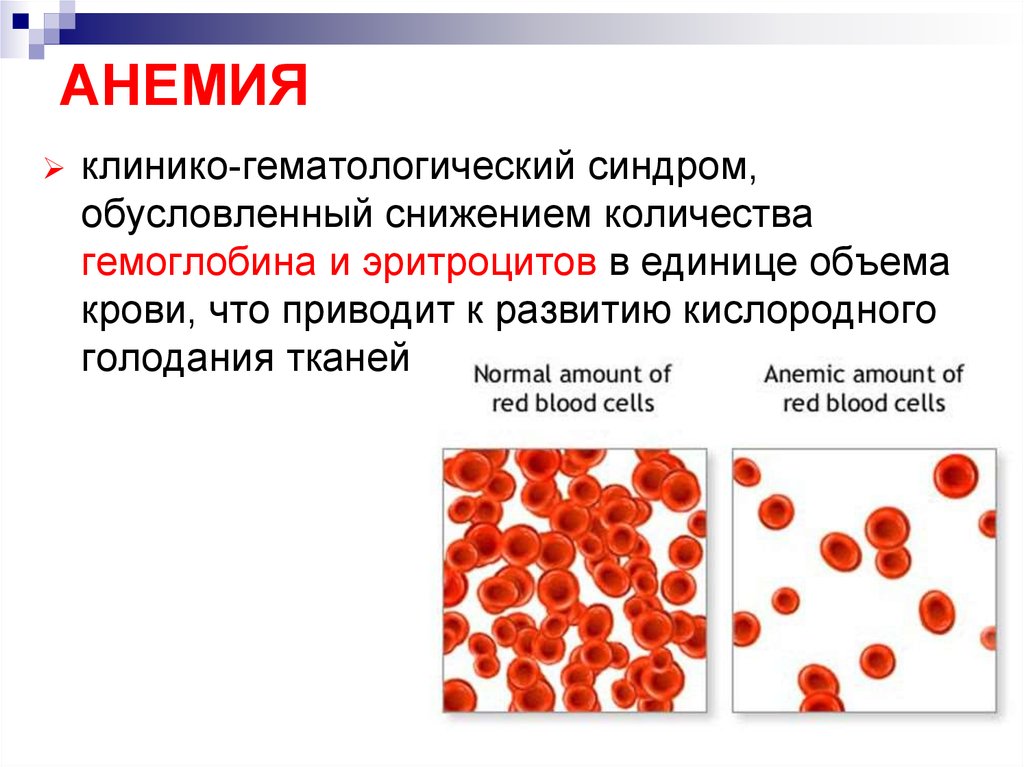 Малокровие причины и лечение. Количество эритроцитов при анемии. Эритроциты в крови анемия.
