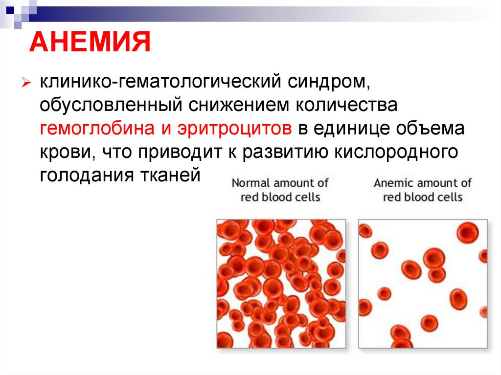 Причины малокровия. Уменьшение гемоглобина. Заболевания, приводящие к развитию анемии. Низкий гемоглобинманемия.