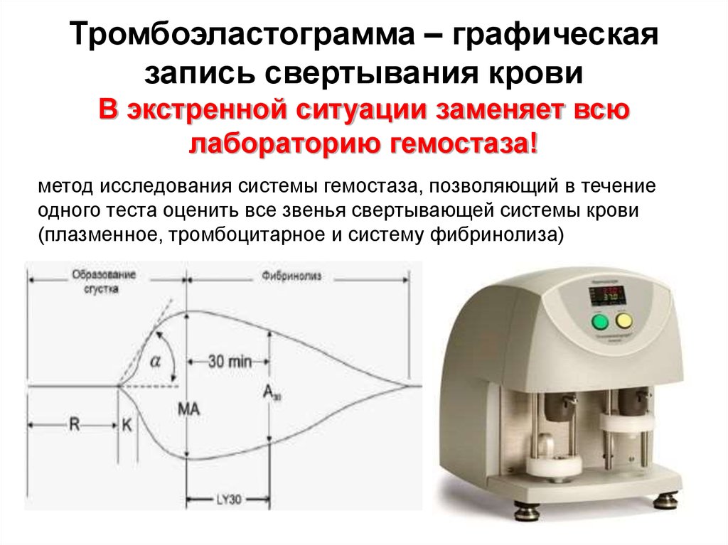 Тест определяющий скорость