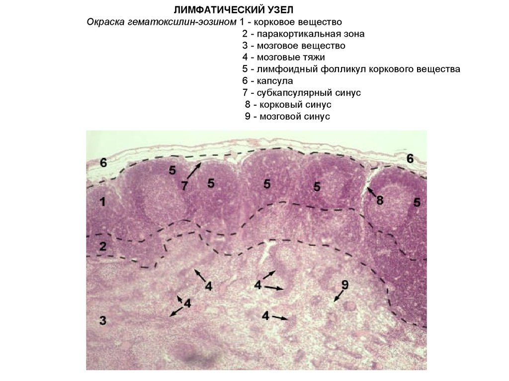 Лимфоузел гистология рисунок