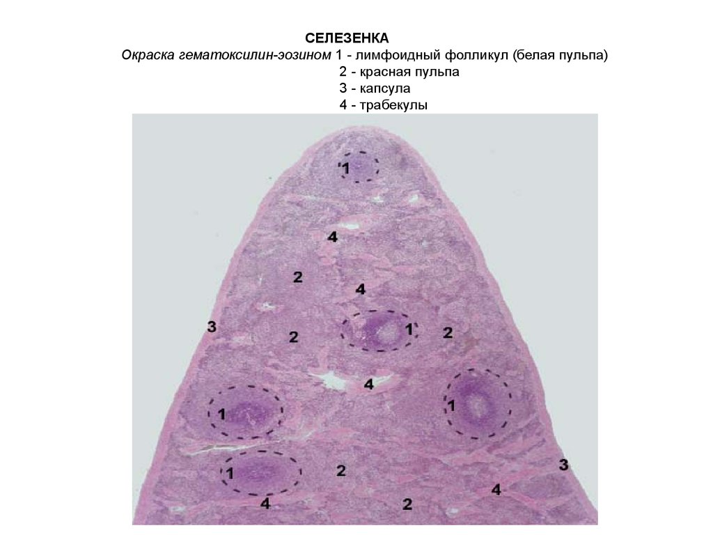 Селезенка гистология рисунок с подписями
