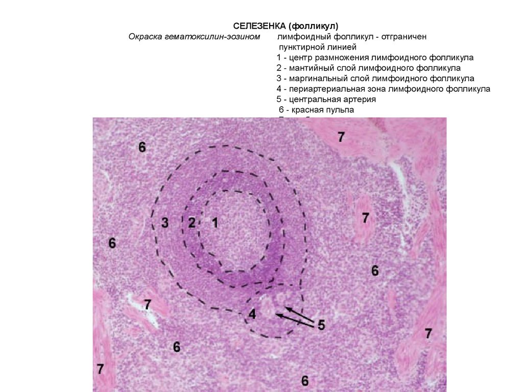 Лимфатический узел гистология рисунок с подписями