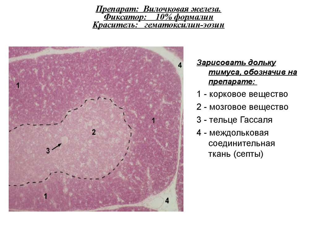 Тимус рисунок препарата