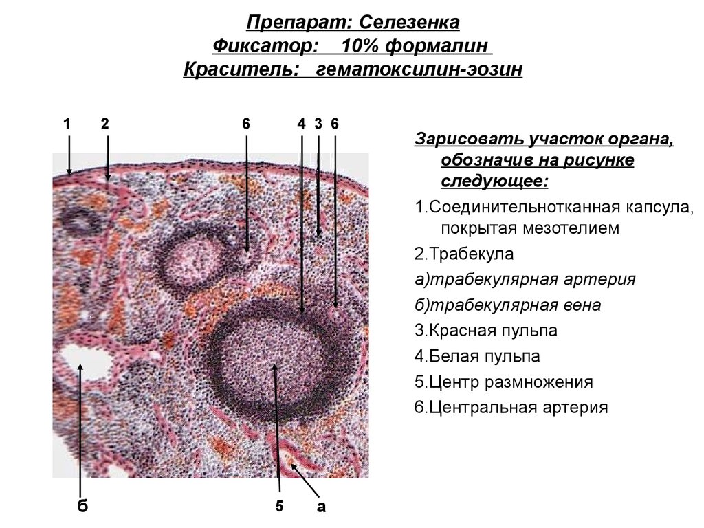 Селезенка рисунок гистология