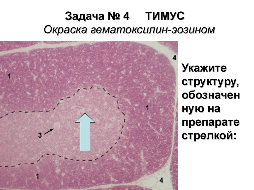 Тимус новорожденного гистология рисунок