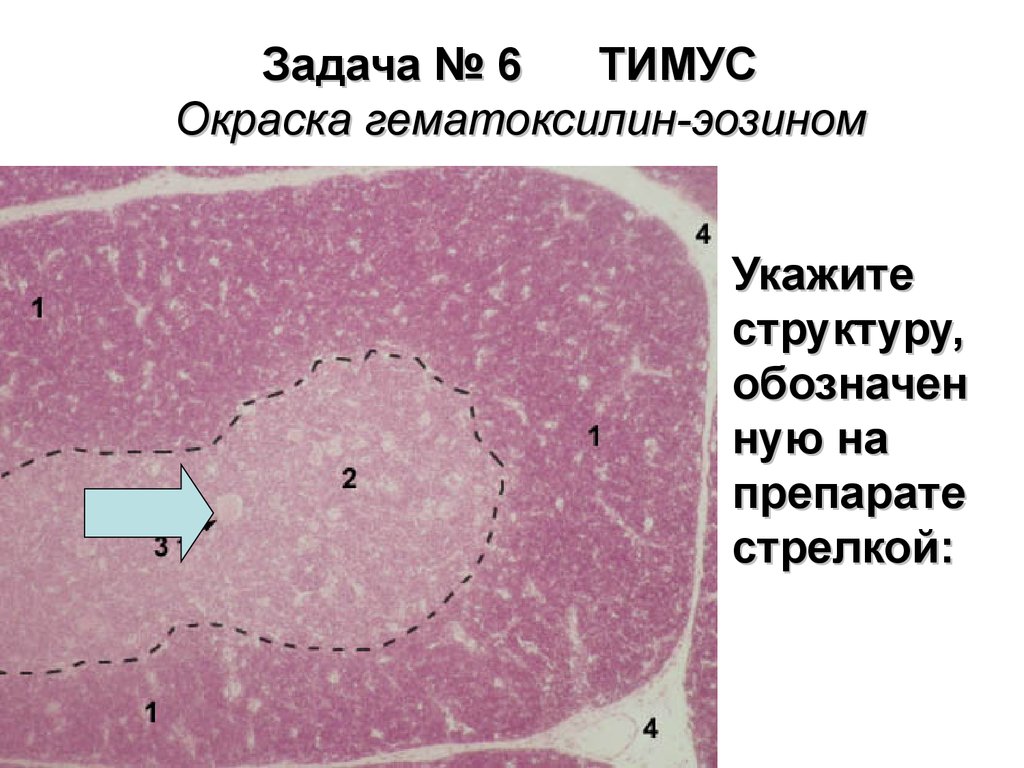 Тимус рисунок препарата