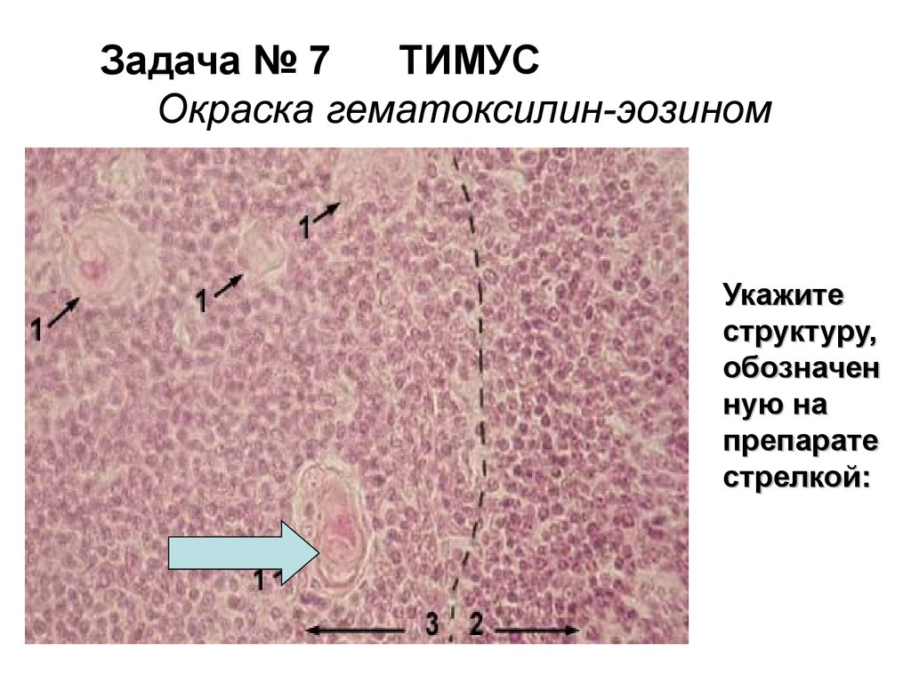 Тимус гематоксилин эозин рисунок