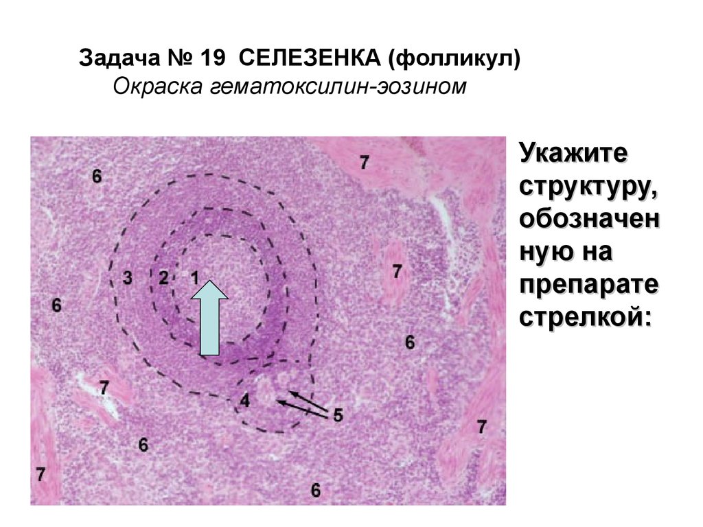 Селезенка препарат рисунок