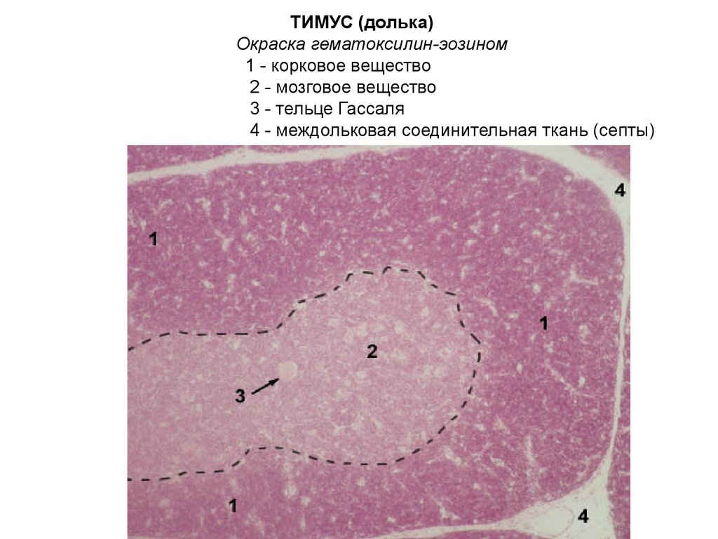 Тимус новорожденного гистология рисунок