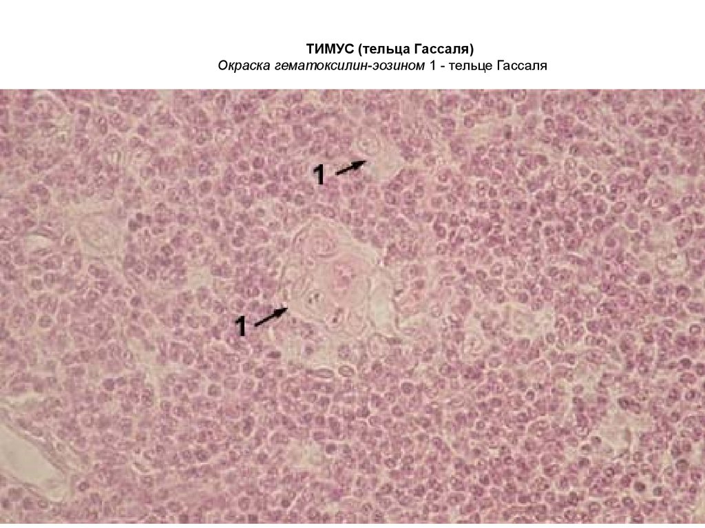 Тимус гематоксилин эозин рисунок