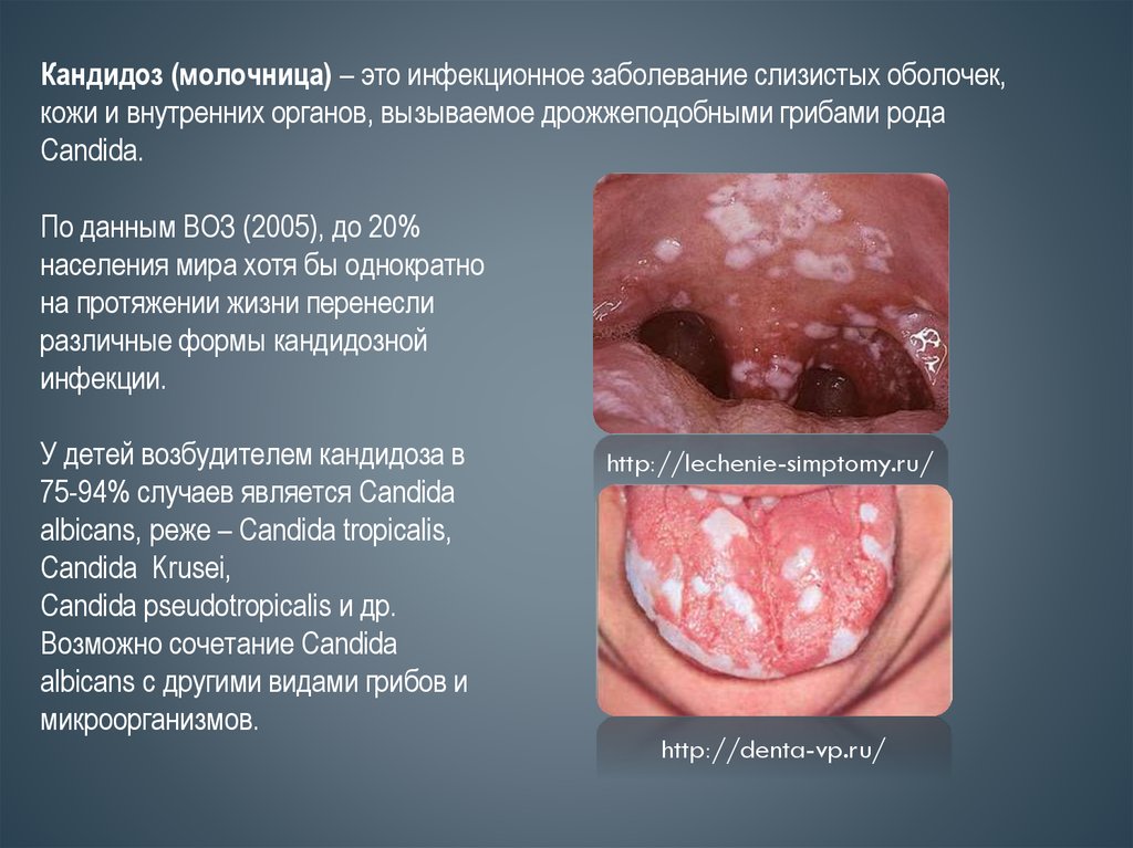 Системные заболевания кожи фото