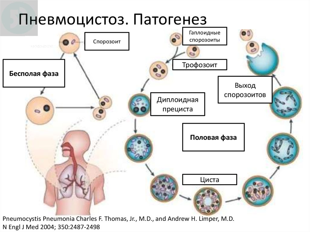 Пневмоцистоз. Пневмоцистная пневмония цикл развития. Pneumocystis CARINII жизненный цикл. Пневмоциста жизненный цикл схема. Пневмоцистис жизненный цикл.