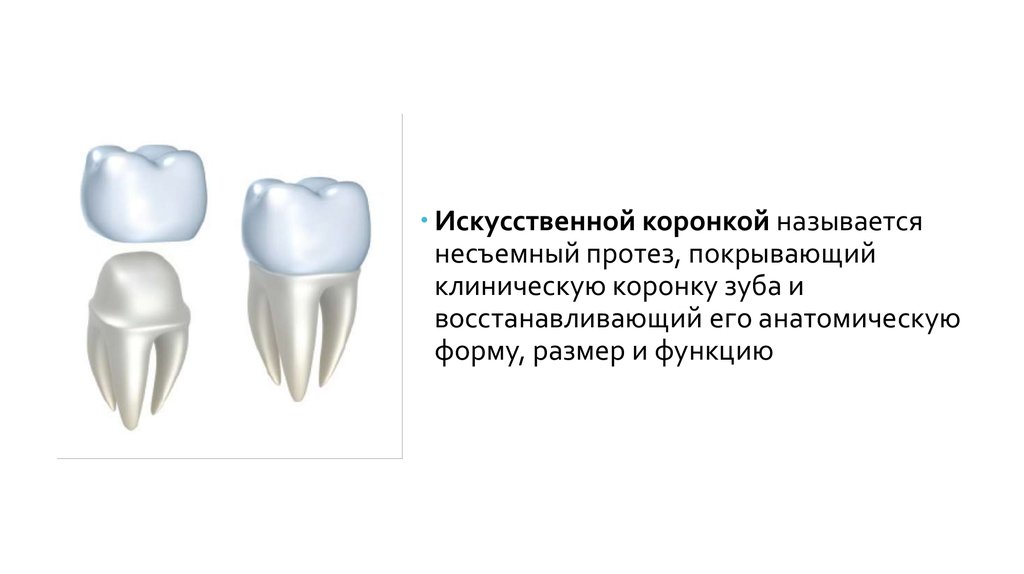 Какую функцию выполняет коронка зуба. Искусственная коронка зуба.