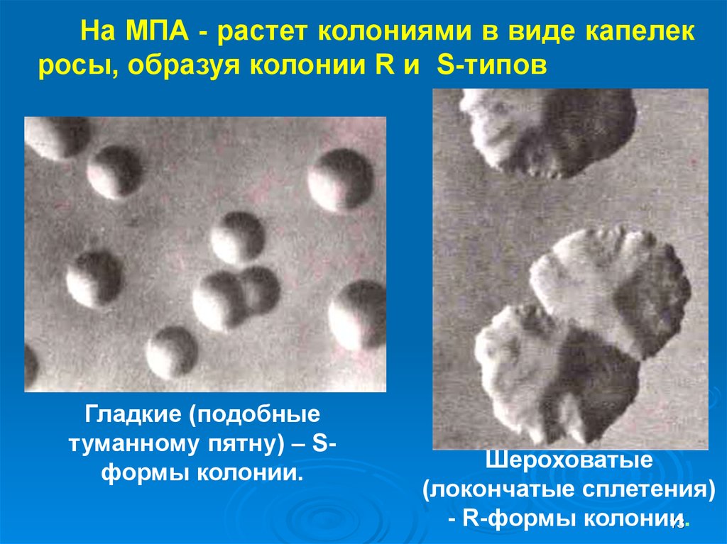 Формы колоний. Гладкие и шероховатые колонии. Колонии s и r формы. R форма колоний. S форма и r форма колоний.