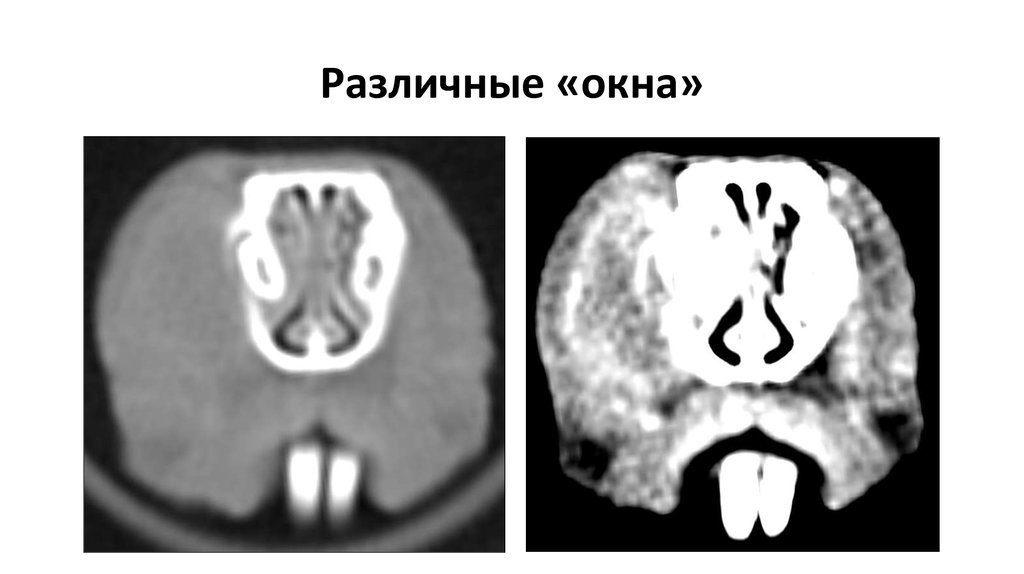 Различные «окна»