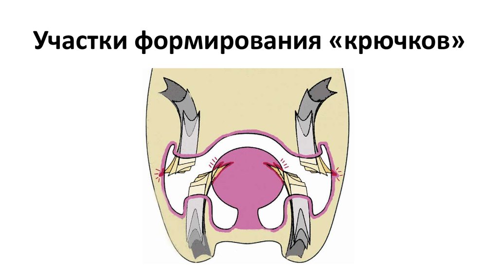 Участки формирования «крючков»