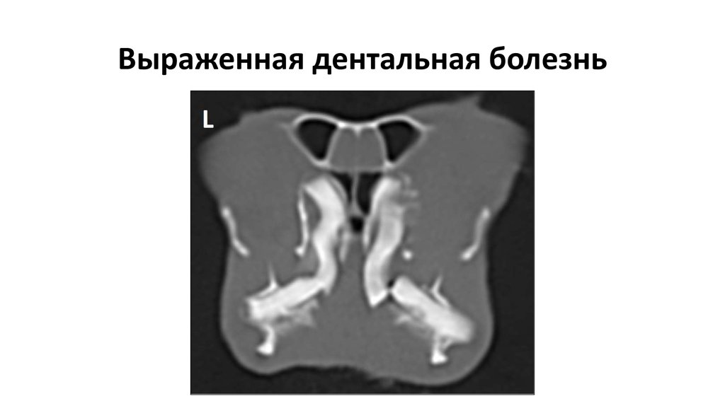 Выраженная дентальная болезнь