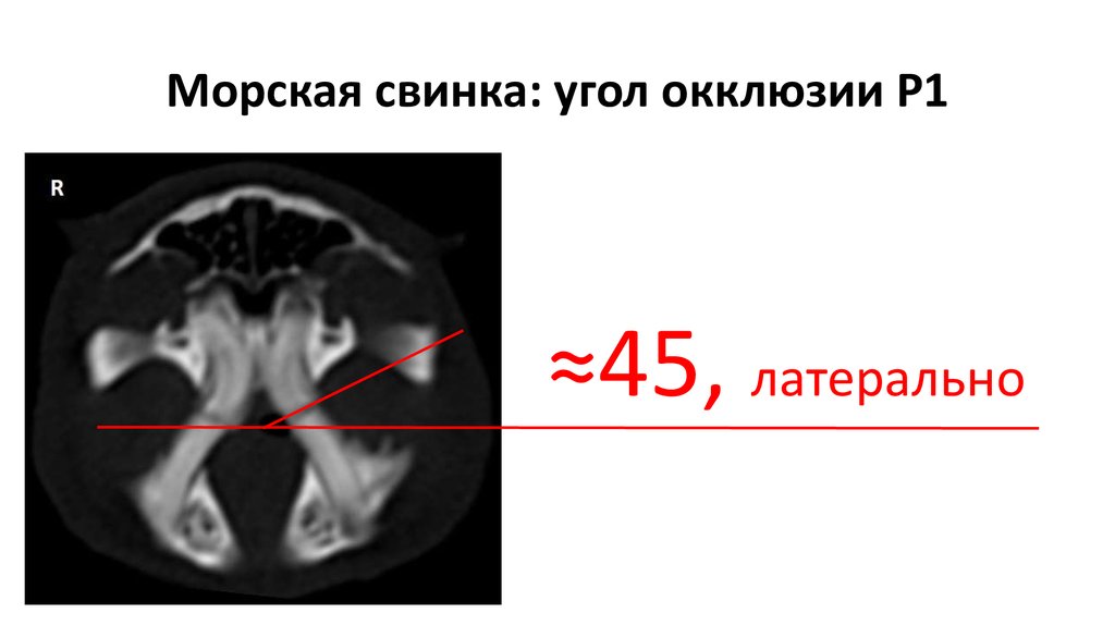 Морская свинка: угол окклюзии P1
