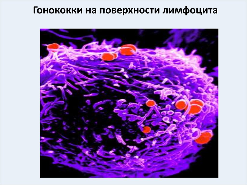 Гонококки на поверхности лимфоцита