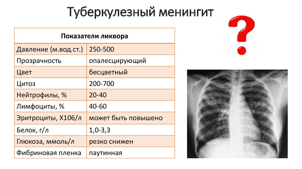 Туберкулезный менингит