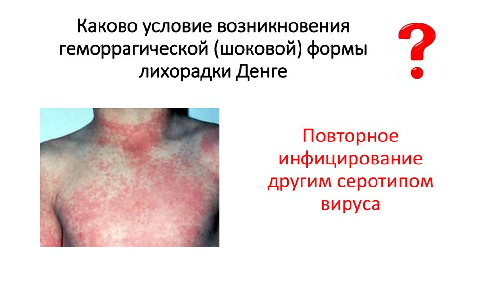 Каково условие возникновения геморрагической (шоковой) формы лихорадки Денге
