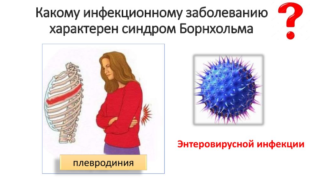 Какому инфекционному заболеванию характерен синдром Борнхольма