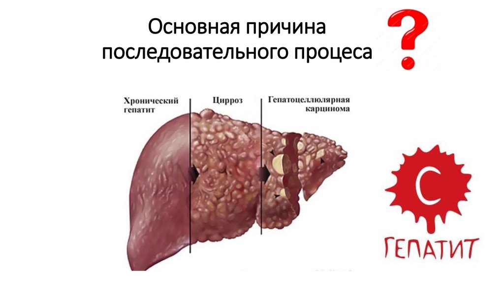 Основная причина последовательного процеса