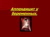 Аппендицит у беременных