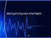 Мерцательная аритмия