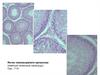 Мужская половая система. Срезы