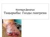 Газды гангрена