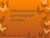 Заболевания щитовидной железы