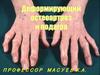 Остеоартроз: клиника, диагностика и современное лечение
