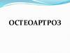 Остеоартроз