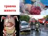 Травма живота