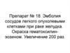 Расстройства кровообращения - тромбоз, эмболия, инфаркт