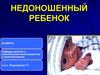 Недоношенные дети
