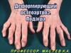 Остеоартроз: клиника, диагностика и современное лечение
