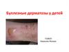 Буллезные дерматозы у детей