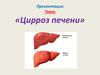 Цирроз печени