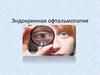 Эндокринная офтальмопатия